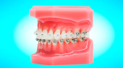 Logo Item